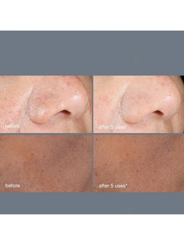 Dermalogica PowerBright Dark Spot Peel