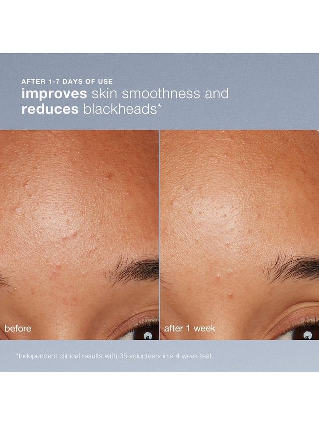 Dermalogica Daily Microfoliant®, Refill