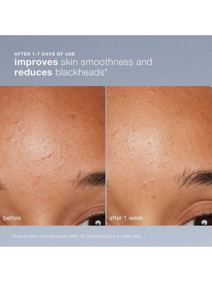 Dermalogica Daily Microfoliant®, Refill